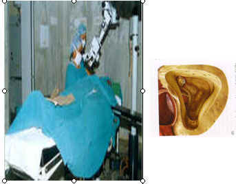 Otology-image