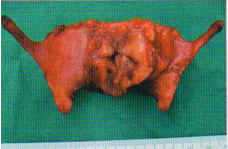 Head-&-Neck-Cancer