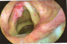 Laryngology-image